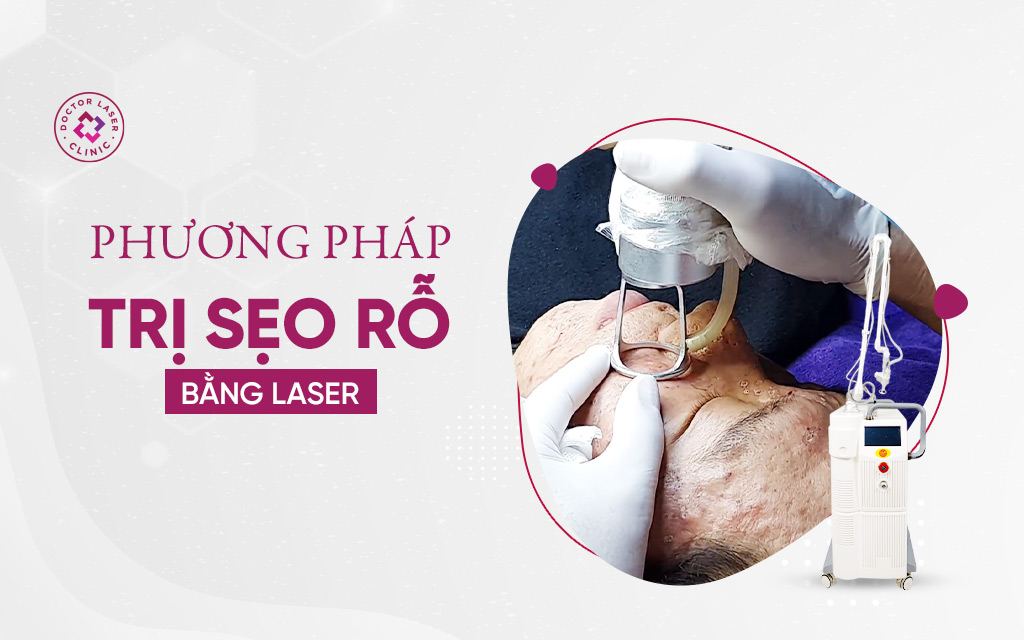 Phương pháp trị sẹo rỗ bằng laser
